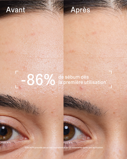 Mascarilla Stick Piel Limpia